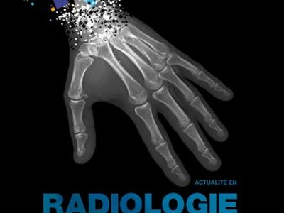 le-nouveau-hors-serie-de-manip-info-traite-de-la-radiologie-numerique