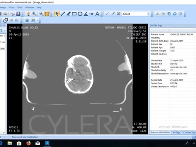 une-image-dicom-infectee-par-du-code-malveillant-oui-cest-possible