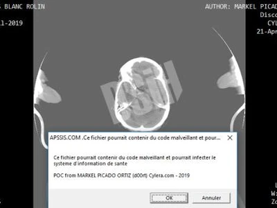 securite-numerique-les-attaquants-ont-ils-toujours-un-temps-davance