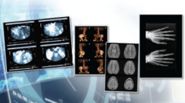 Illustration OKI lance la première gamme d’imprimantes avec DICOM intégré destinées au secteur de l’imagerie médicale