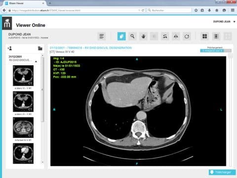 Illustration L'hôpital sans film grâce à la diffusion Web automatique ETIAM