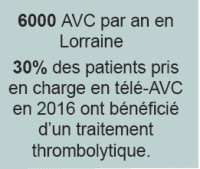 Illustration La barre des 1000 télé-expertises AVC franchie en Lorraine / Vies sauvées et séquelles graves évitées grâce à la Télémédecine