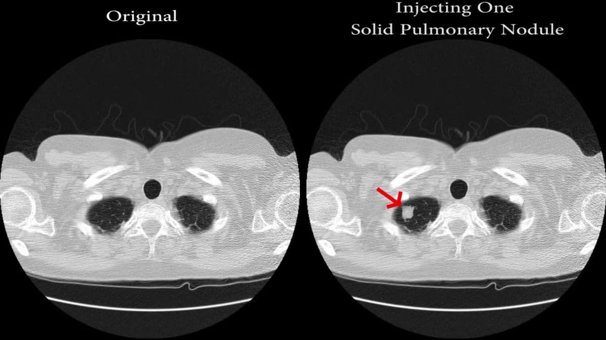 Illustration Altération des données d’imagerie médicale pour faire croire à un cancer : qu’en est-il réellement ?
