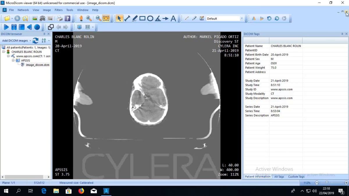 Illustration Une image DICOM « infectée » par du code malveillant, oui c’est possible !