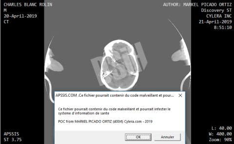 Illustration Vulnérabilités 0 day à la chaîne, RSSI sous antidépresseurs et DSI sous amphétamines