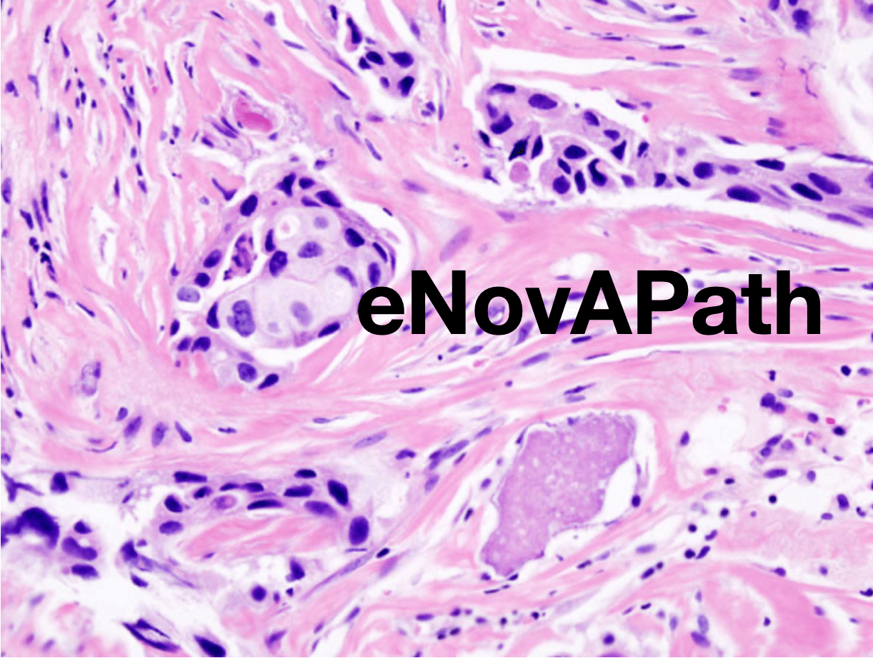 Illustration Le projet eNovA-Path : une plateforme de numérisation et d’échange des données d’anatomopathologie au service des patients en Nouvelle-Aquitaine